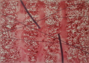 Thumbnail Placeholder